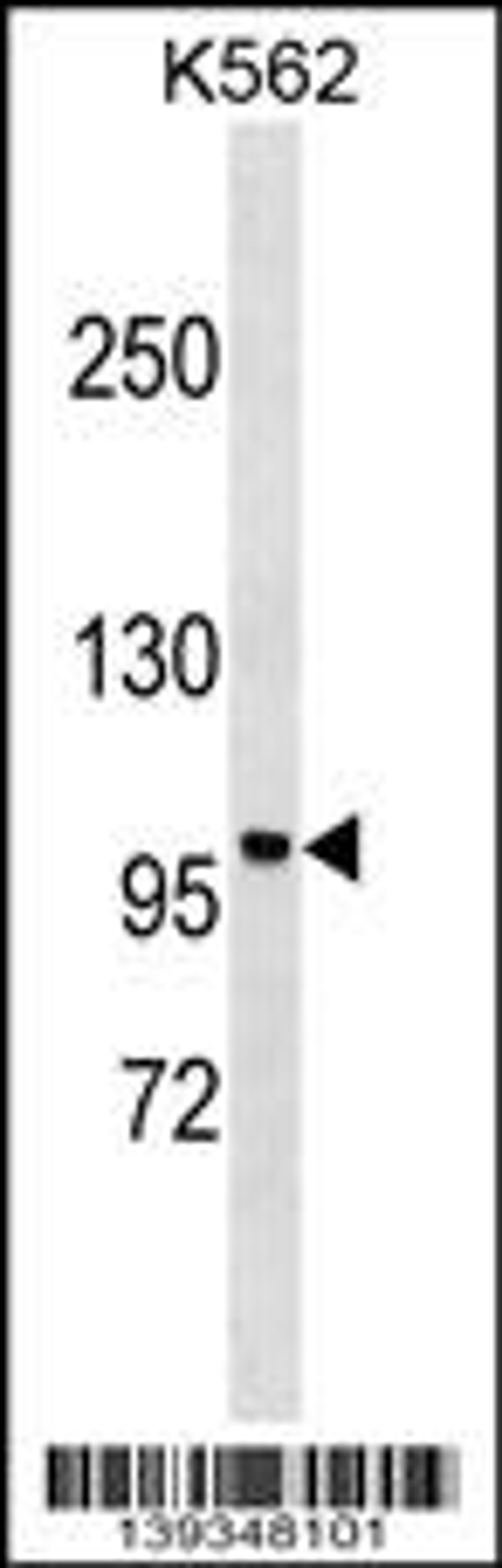 Western blot analysis in K562 cell line lysates (35ug/lane).