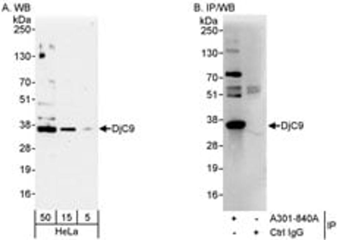 Detection of human DjC9 by western blot and immunoprecipitation.