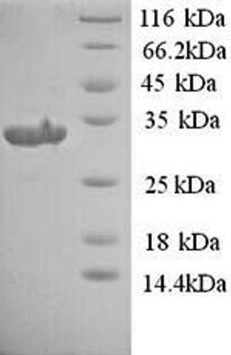 (Tris-Glycine gel) Discontinuous SDS-PAGE (reduced) with 5% enrichment gel and 15% separation gel.