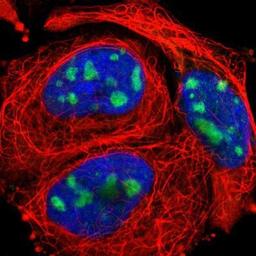 Immunocytochemistry/Immunofluorescence: KIAA0020 Antibody [NBP1-87296] - Staining of human cell line A-431 shows positivity in nucleoli.