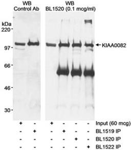 Detection of human KIAA0082 by western blot and immunoprecipitation.