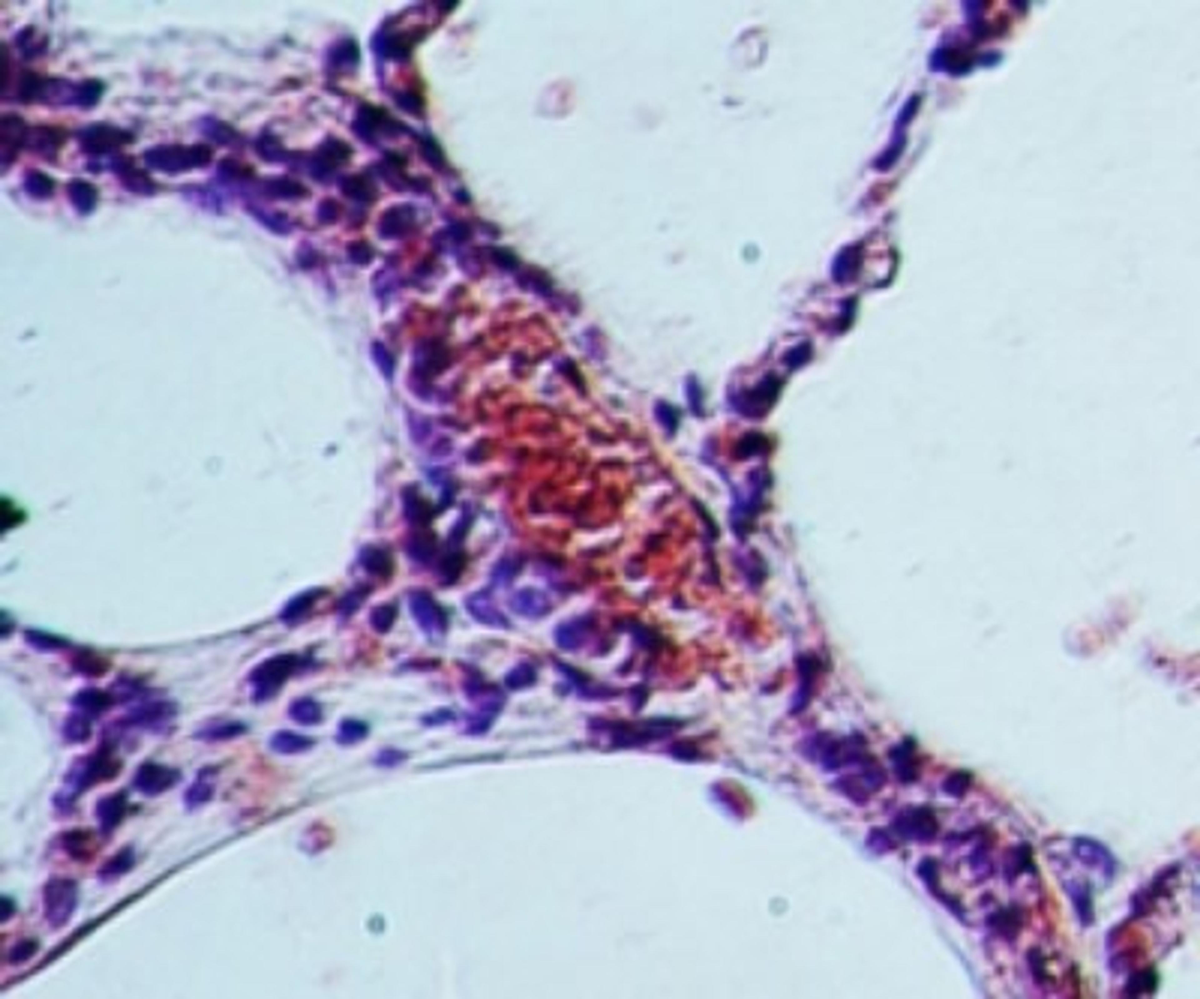 Immunohistochemistry-Paraffin: SGK1 Antibody [NBP2-19010] - analysis of SGK1 in human lung probed with SGK1 antibody at 5 ug/ml.