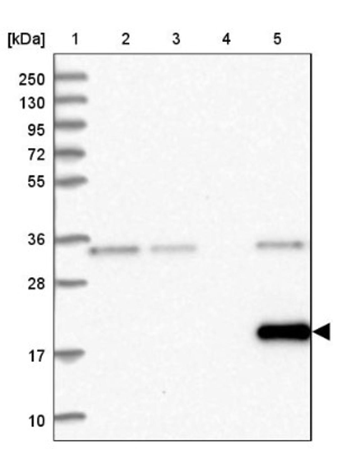 Western Blot: FKBP11 Antibody [NBP1-84678] - Lane 1: Marker [kDa] 250, 130, 95, 72, 55, 36, 28, 17, 10<br/>Lane 2: Human cell line RT-4<br/>Lane 3: Human cell line U-251MG sp<br/>Lane 4: Human plasma (IgG/HSA depleted)<br/>Lane 5: Human liver tissue