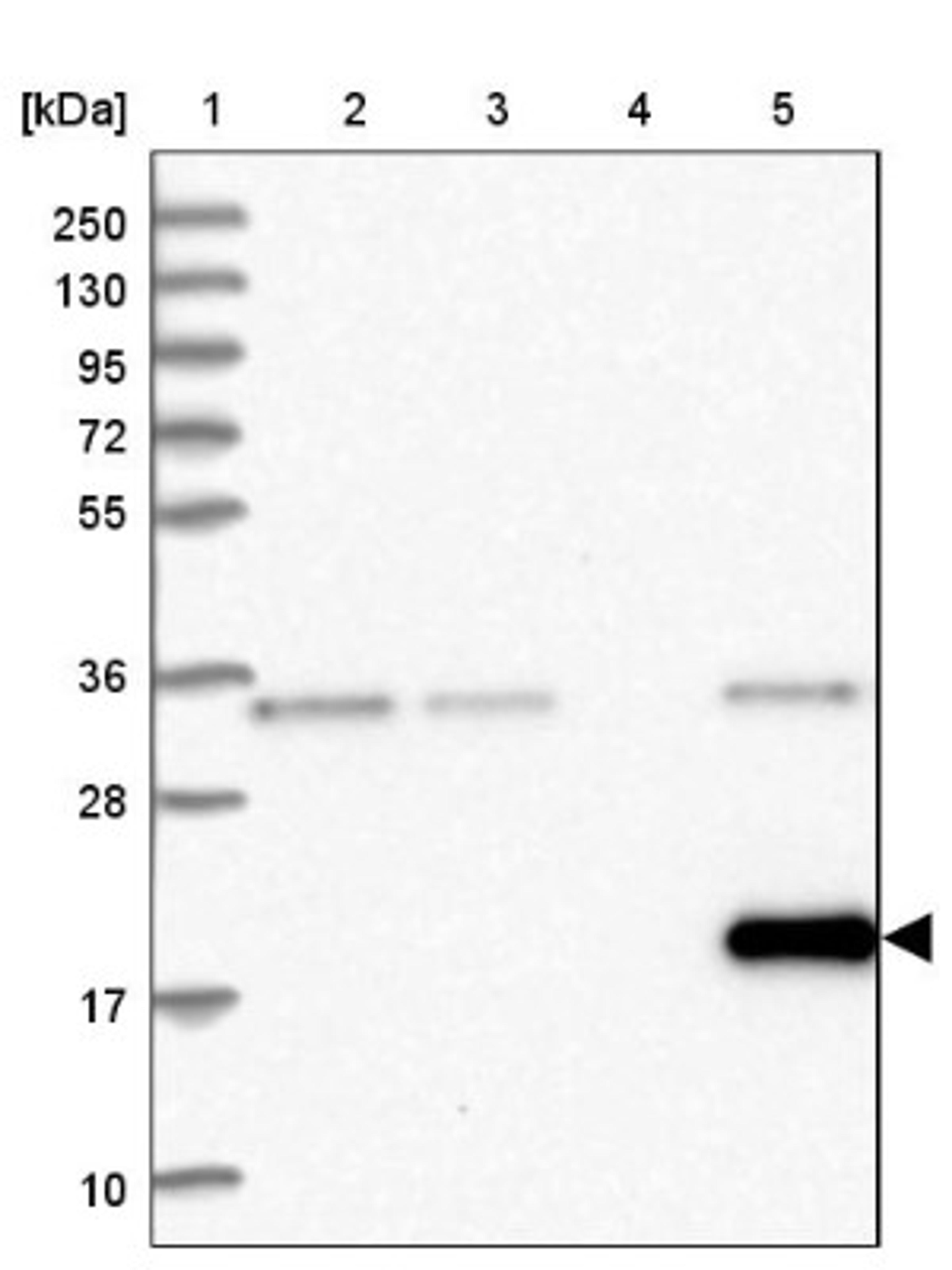 Western Blot: FKBP11 Antibody [NBP1-84678] - Lane 1: Marker [kDa] 250, 130, 95, 72, 55, 36, 28, 17, 10<br/>Lane 2: Human cell line RT-4<br/>Lane 3: Human cell line U-251MG sp<br/>Lane 4: Human plasma (IgG/HSA depleted)<br/>Lane 5: Human liver tissue