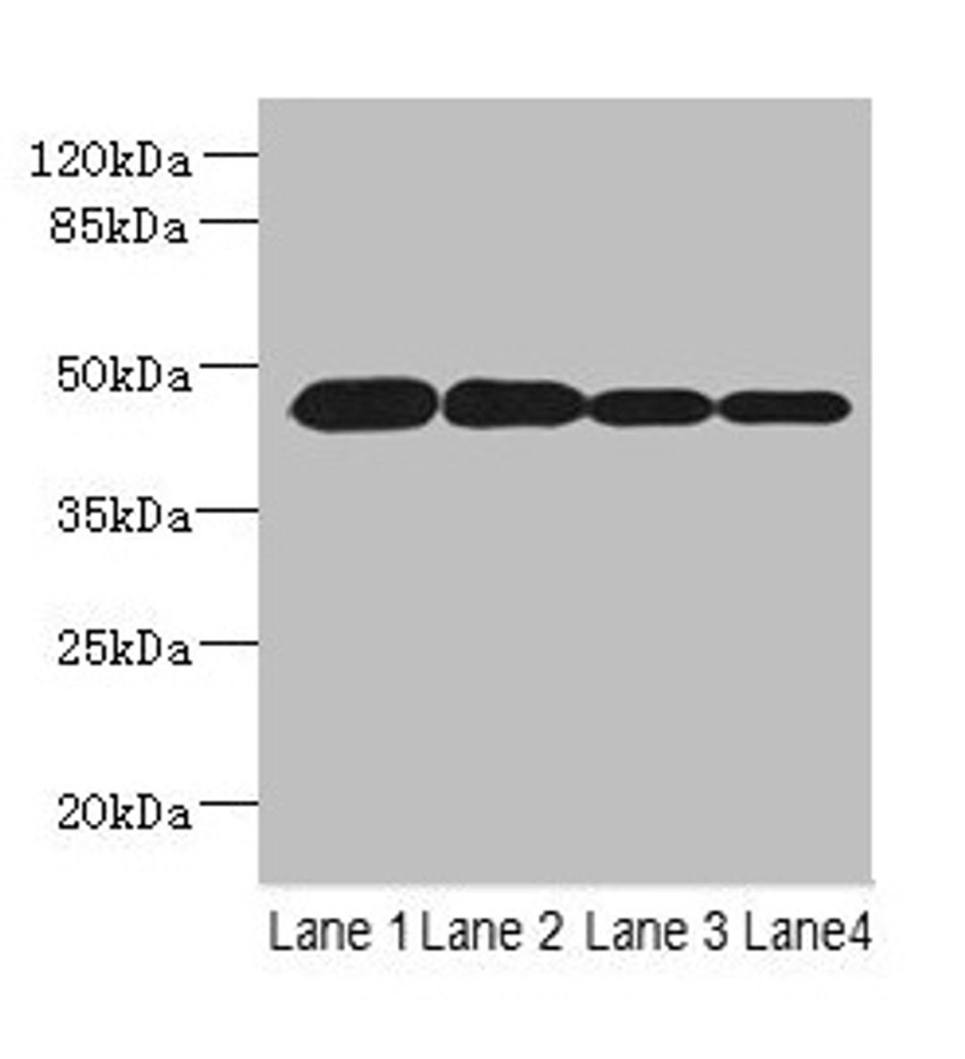 Western blot. All lanes: PCOLCE2 antibody at 8µg/ml. Lane 1: MCF-7 whole cell lysate. Lane 2: A549 whole cell lysate. Lane 3: HCT116 whole cell lysate. Lane 4: Human high value serum. Secondary. Goat polyclonal to rabbit IgG at 1/10000 dilution. Predicted band size: 46 kDa. Observed band size: 46 kDa