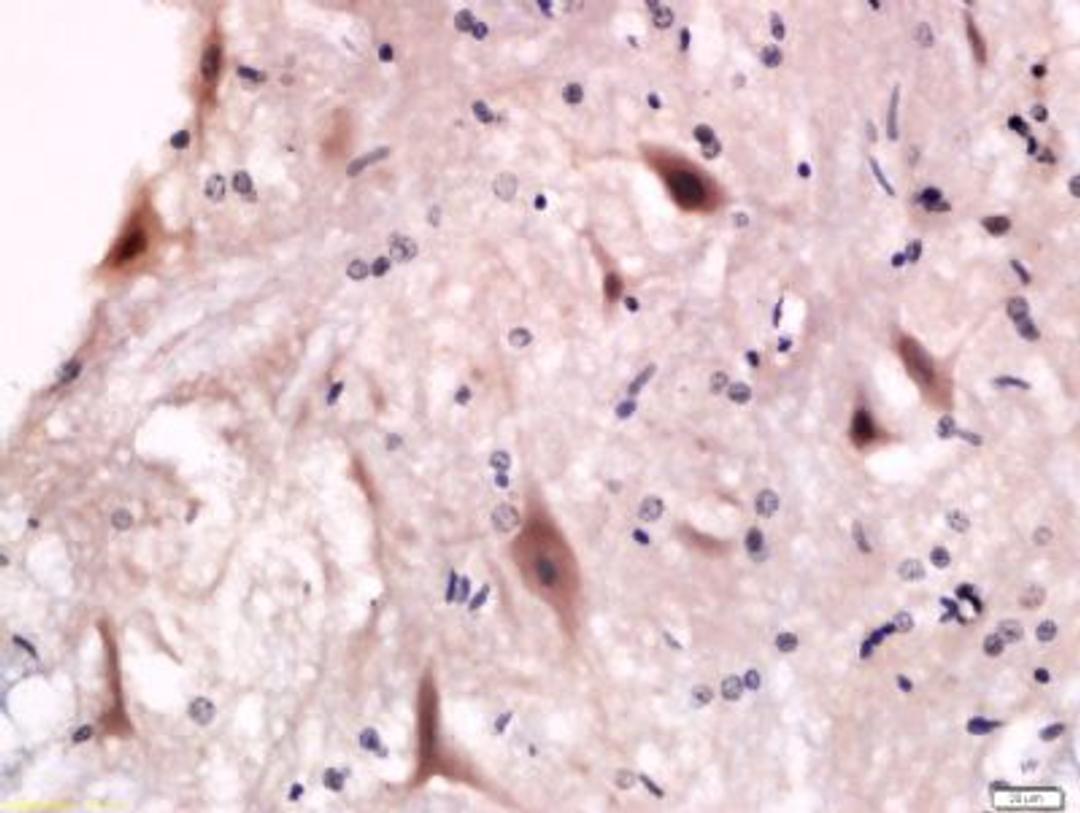 Immunohistochemical staining of Anterior horn of spinal cord in rats Cell using P2Y12 antibody.