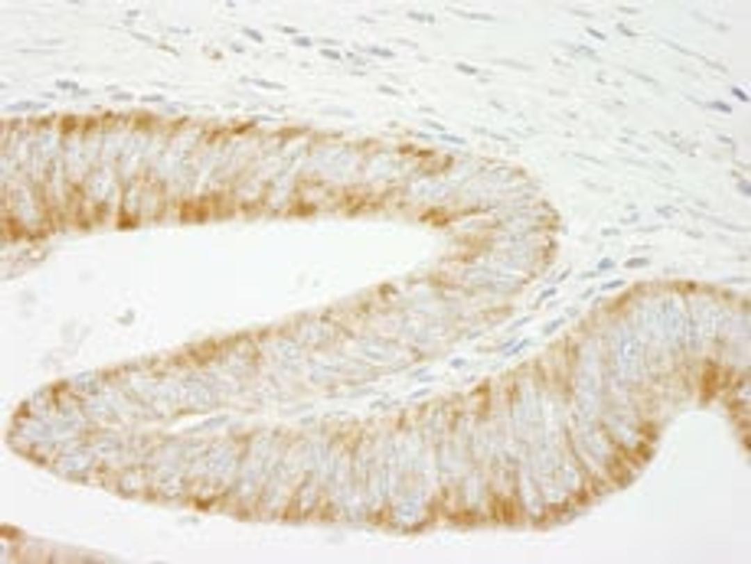 Detection of human INPPL1/SHIP2 by immunohistochemistry.