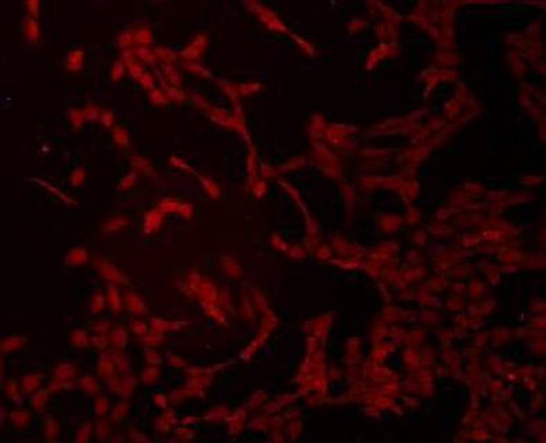 Immunofluorescent staining of NIH/3T3 cells using Transmembrane protein 200A antibody