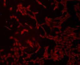 Immunofluorescent staining of NIH/3T3 cells using Transmembrane protein 200A antibody