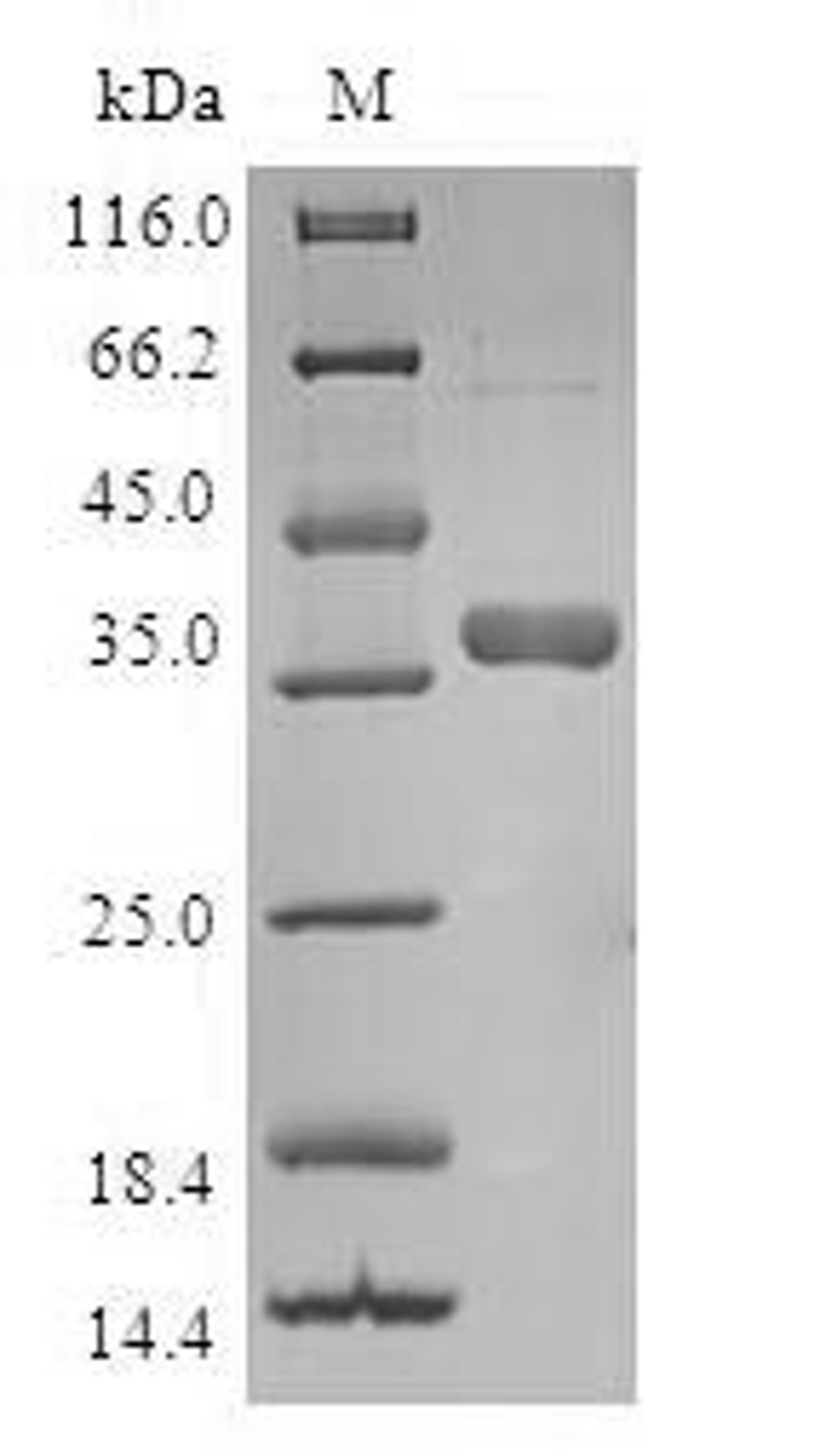 (Tris-Glycine gel) Discontinuous SDS-PAGE (reduced) with 5% enrichment gel and 15% separation gel.