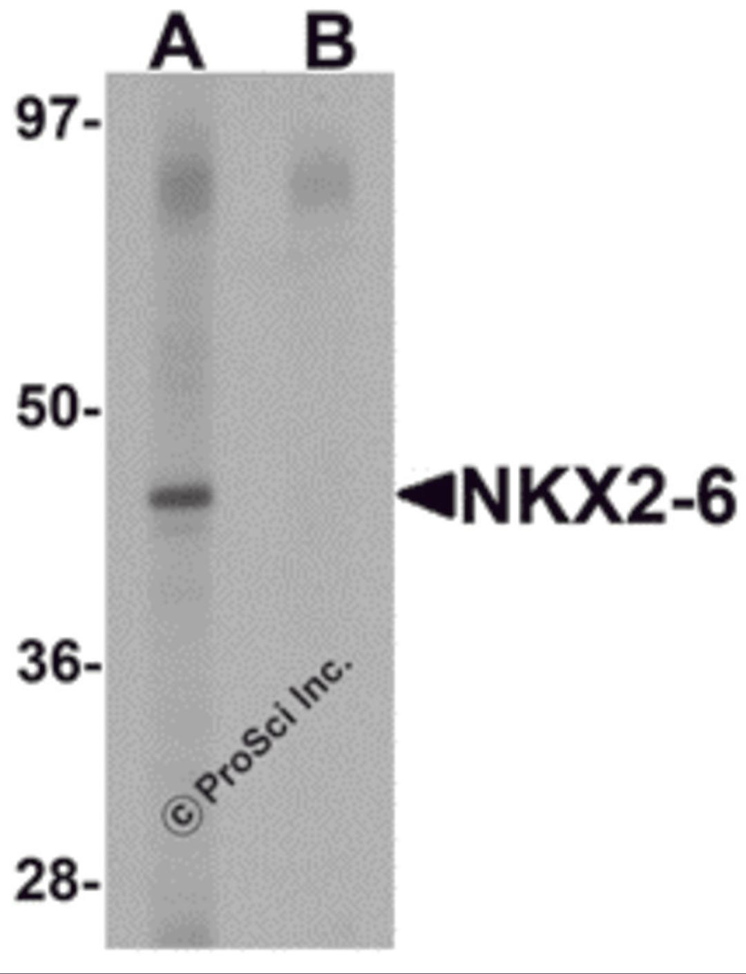 Western blot analysis of NKX2-6 in mouse heart tissue lysate with NKX2-6 antibody at 1 &#956;g/mL in (A) the absence and (B) the presence of blocking peptide.