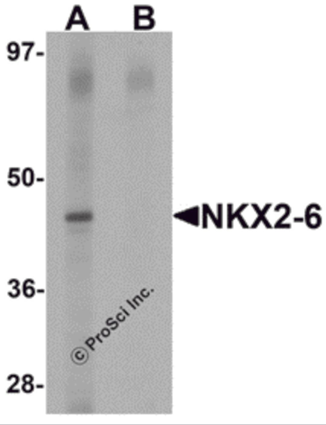 Western blot analysis of NKX2-6 in mouse heart tissue lysate with NKX2-6 antibody at 1 μg/mL in (A) the absence and (B) the presence of blocking peptide.