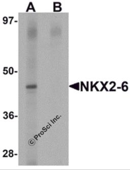 Western blot analysis of NKX2-6 in mouse heart tissue lysate with NKX2-6 antibody at 1 μg/mL in (A) the absence and (B) the presence of blocking peptide.