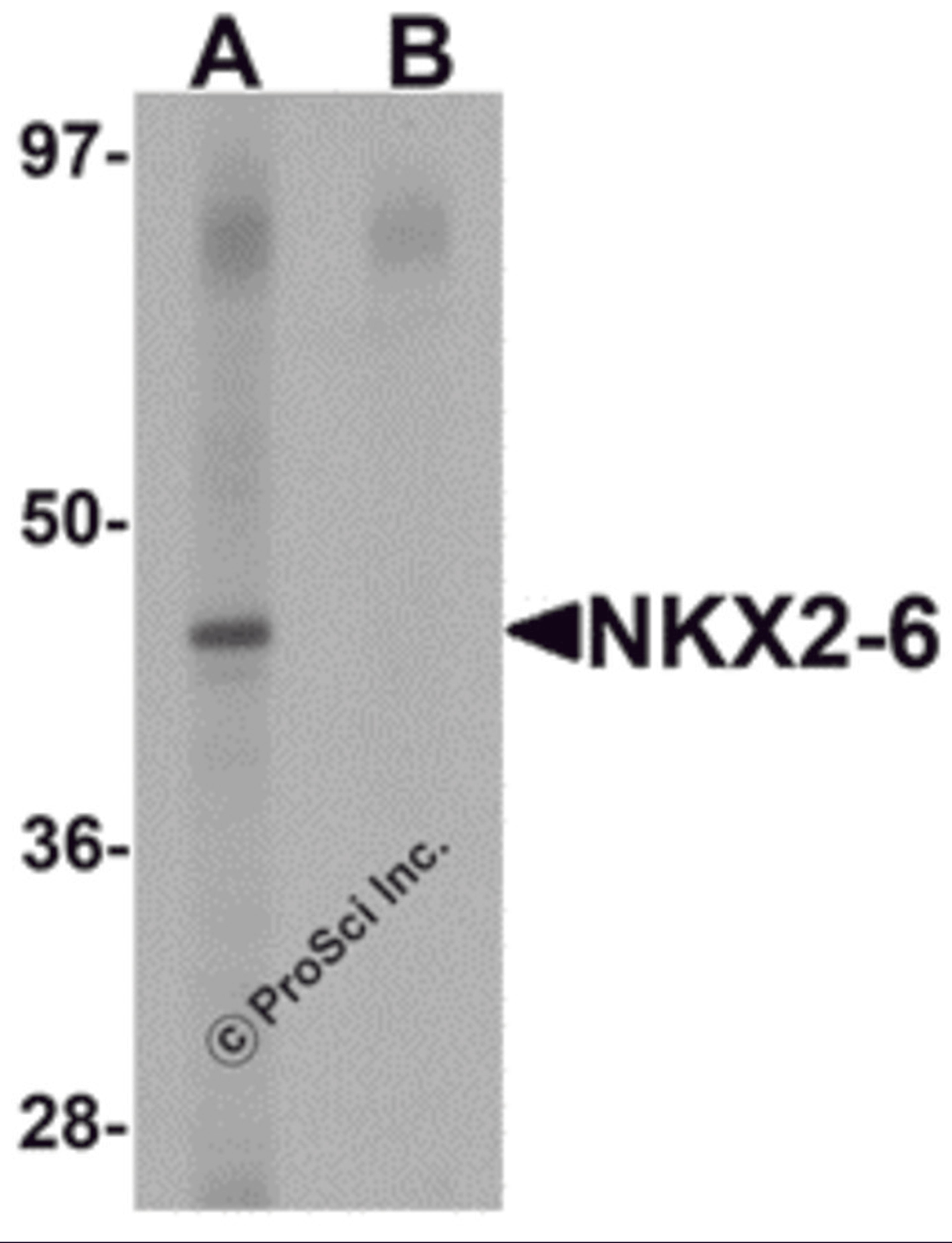 Western blot analysis of NKX2-6 in mouse heart tissue lysate with NKX2-6 antibody at 1 μg/mL in (A) the absence and (B) the presence of blocking peptide.