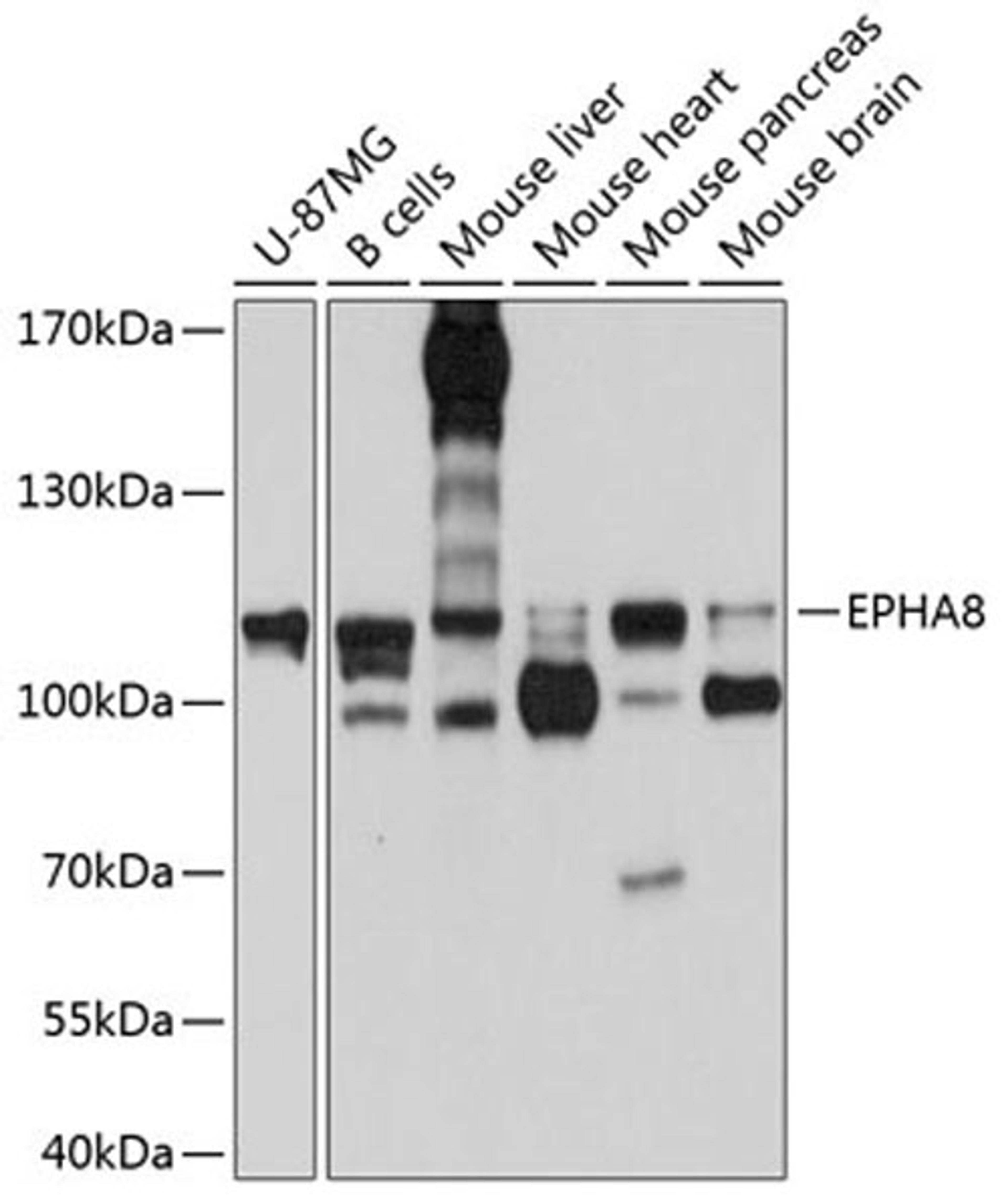 Western blot - EPHA8 antibody (A10213)