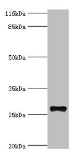 Western blot. All lanes: TSPAN6 antibody at 20µg/ml + Mouse liver tissue. Secondary. Goat polyclonal to rabbit IgG at 1/10000 dilution. Predicted band size: 28 kDa. Observed band size: 28 kDa
