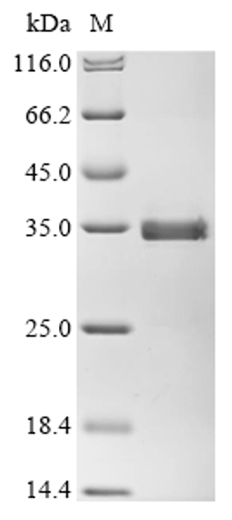 (Tris-Glycine gel) Discontinuous SDS-PAGE (reduced) with 5% enrichment gel and 15% separation gel.
