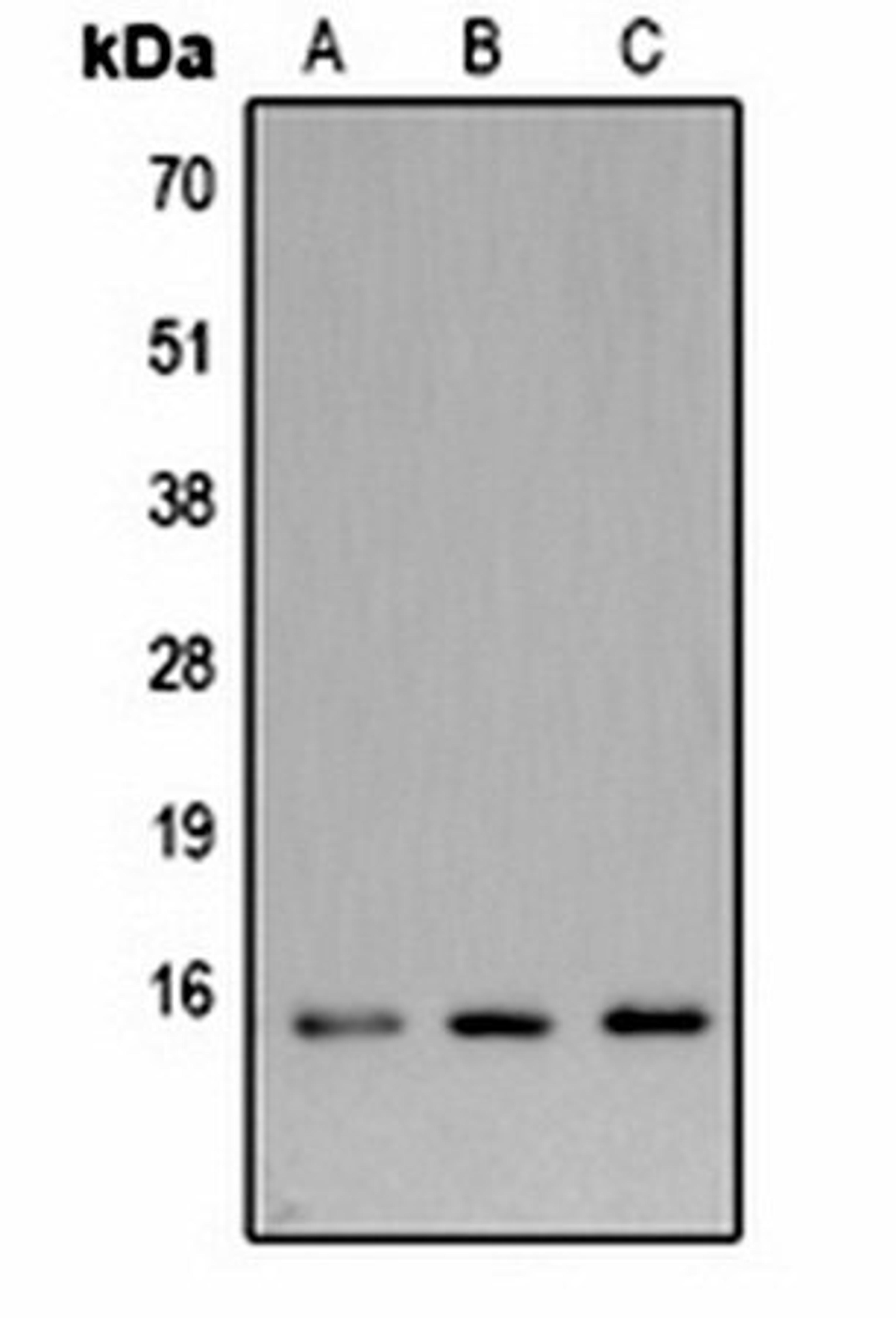 Western blot analysis of  Hela (Lane1), NIH3T3 (Lane2), rat brain (Lane3) whole cell lysates using LC3B antibody