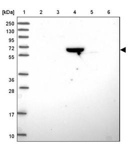 Western Blot: ZNF304 Antibody [NBP2-31901] - Lane 1: Marker [kDa] 250, 130, 95, 72, 55, 36, 28, 17, 10<br/>Lane 2: Human cell line RT-4<br/>Lane 3: Human cell line U-251MG sp<br/>Lane 4: Human plasma (IgG/HSA depleted)<br/>Lane 5: Human liver tissue<br/>Lane 6: Human tonsil tissue