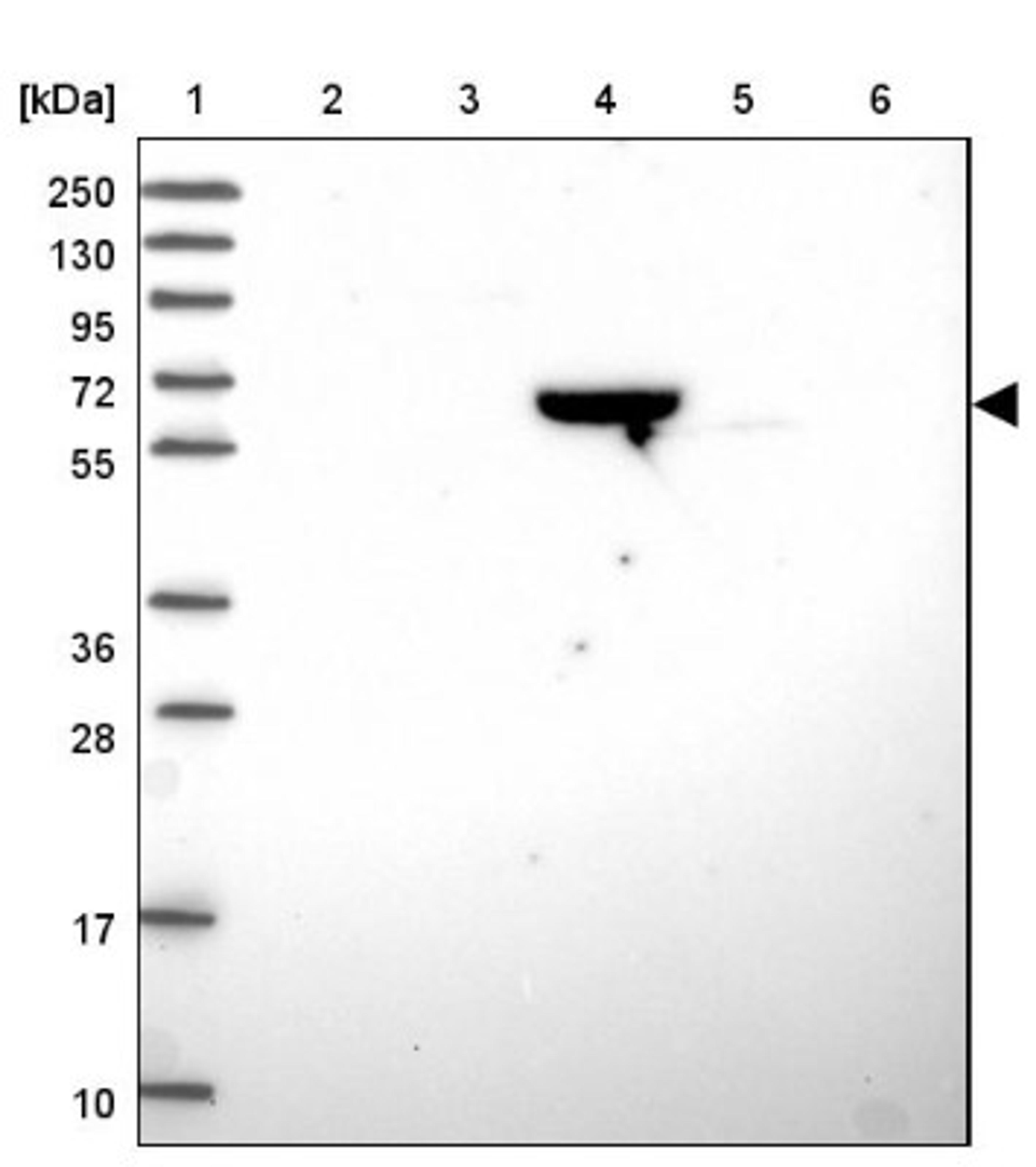 Western Blot: ZNF304 Antibody [NBP2-31901] - Lane 1: Marker [kDa] 250, 130, 95, 72, 55, 36, 28, 17, 10<br/>Lane 2: Human cell line RT-4<br/>Lane 3: Human cell line U-251MG sp<br/>Lane 4: Human plasma (IgG/HSA depleted)<br/>Lane 5: Human liver tissue<br/>Lane 6: Human tonsil tissue