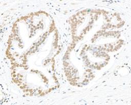 Detection of human Phospho-RPA32 (S4/S8) by immunohistochemistry.