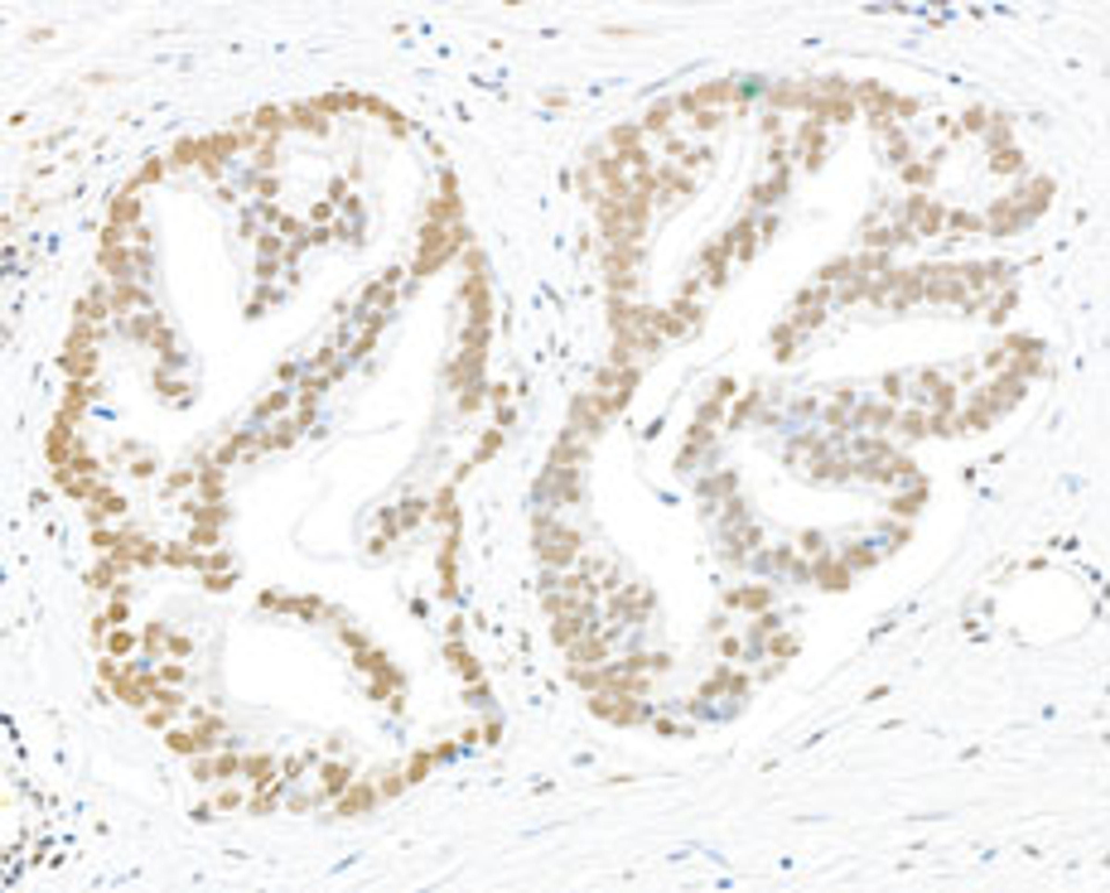 Detection of human Phospho-RPA32 (S4/S8) by immunohistochemistry.