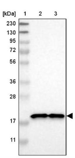 Western Blot: NDUFB7 Antibody [NBP1-88938] - Lane 1: Marker [kDa] 230, 130, 95, 72, 56, 36, 28, 17, 11<br/>Lane 2: Human cell line RT-4<br/>Lane 3: Human cell line U-251MG sp