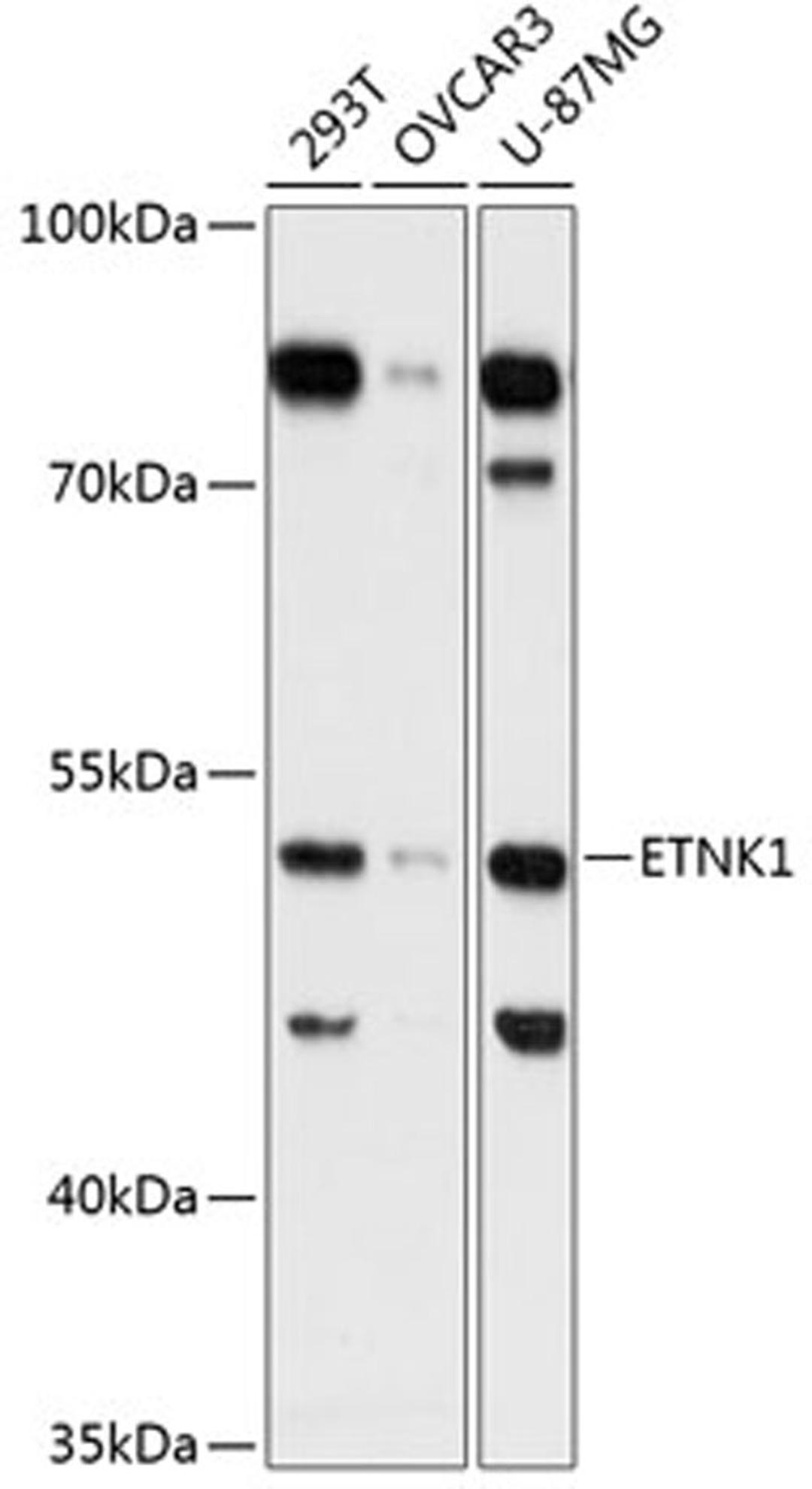 Western blot - ETNK1 Antibody (A13224)