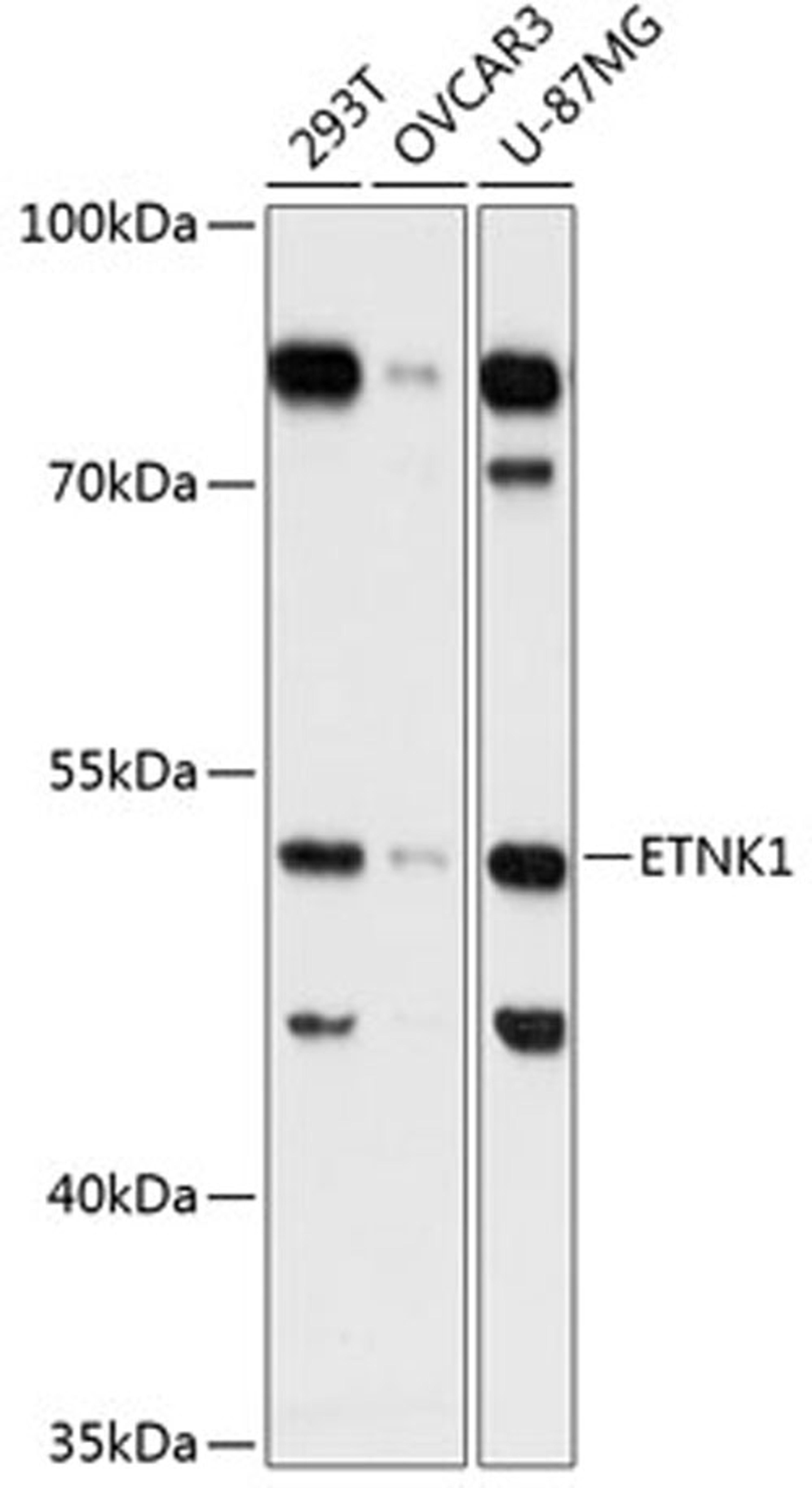 Western blot - ETNK1 Antibody (A13224)