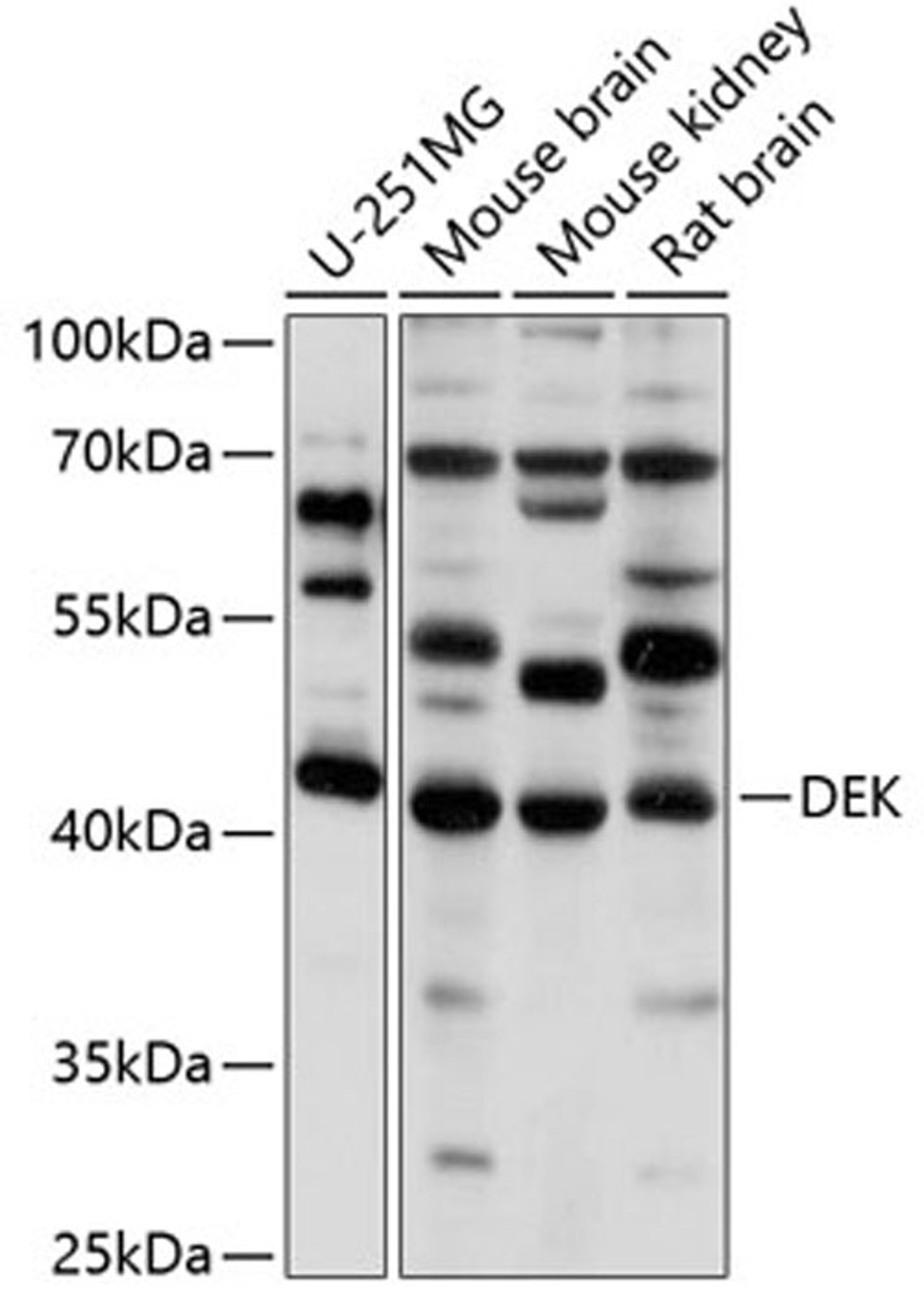 Western blot - DEK antibody (A5901)