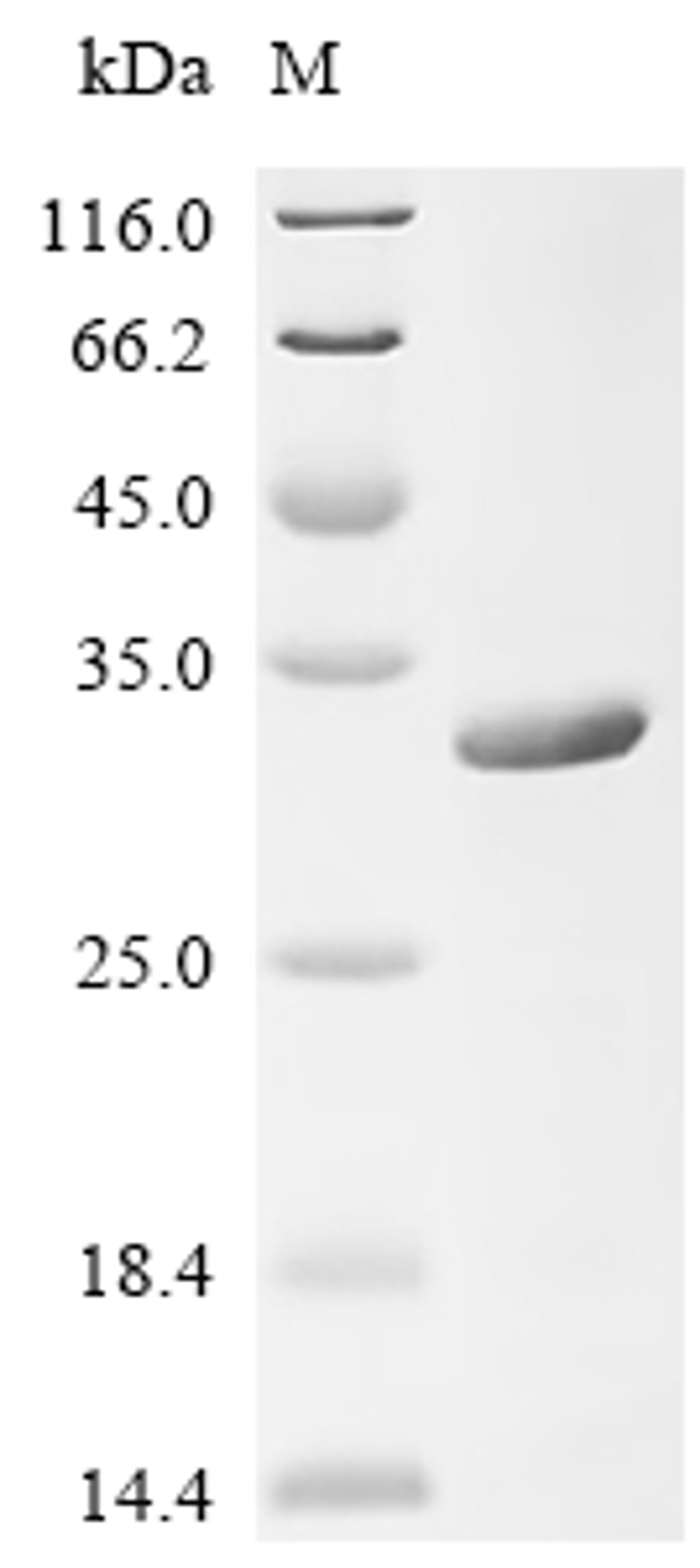 (Tris-Glycine gel) Discontinuous SDS-PAGE (reduced) with 5% enrichment gel and 15% separation gel.