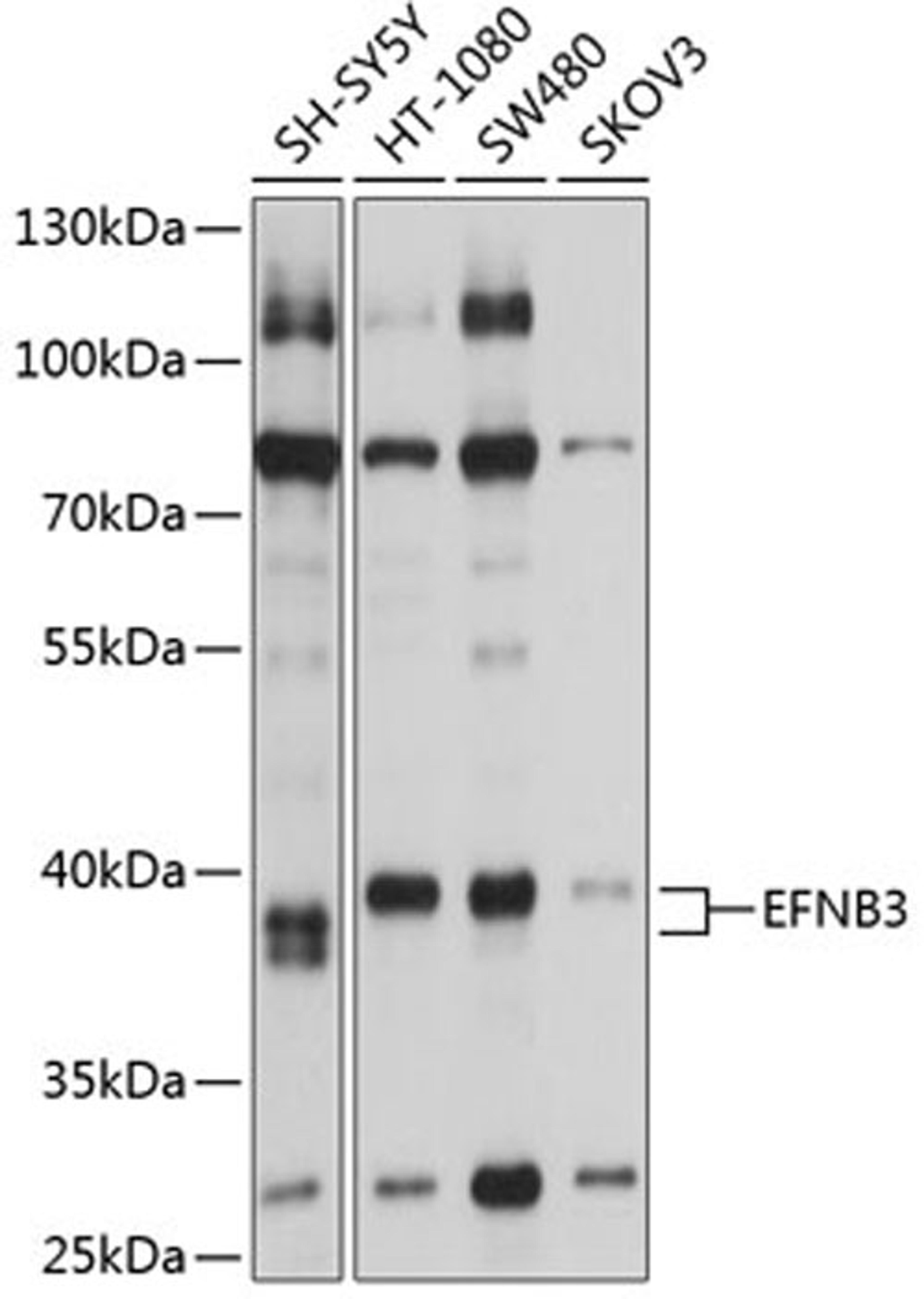 Western blot - EFNB3 antibody (A2916)