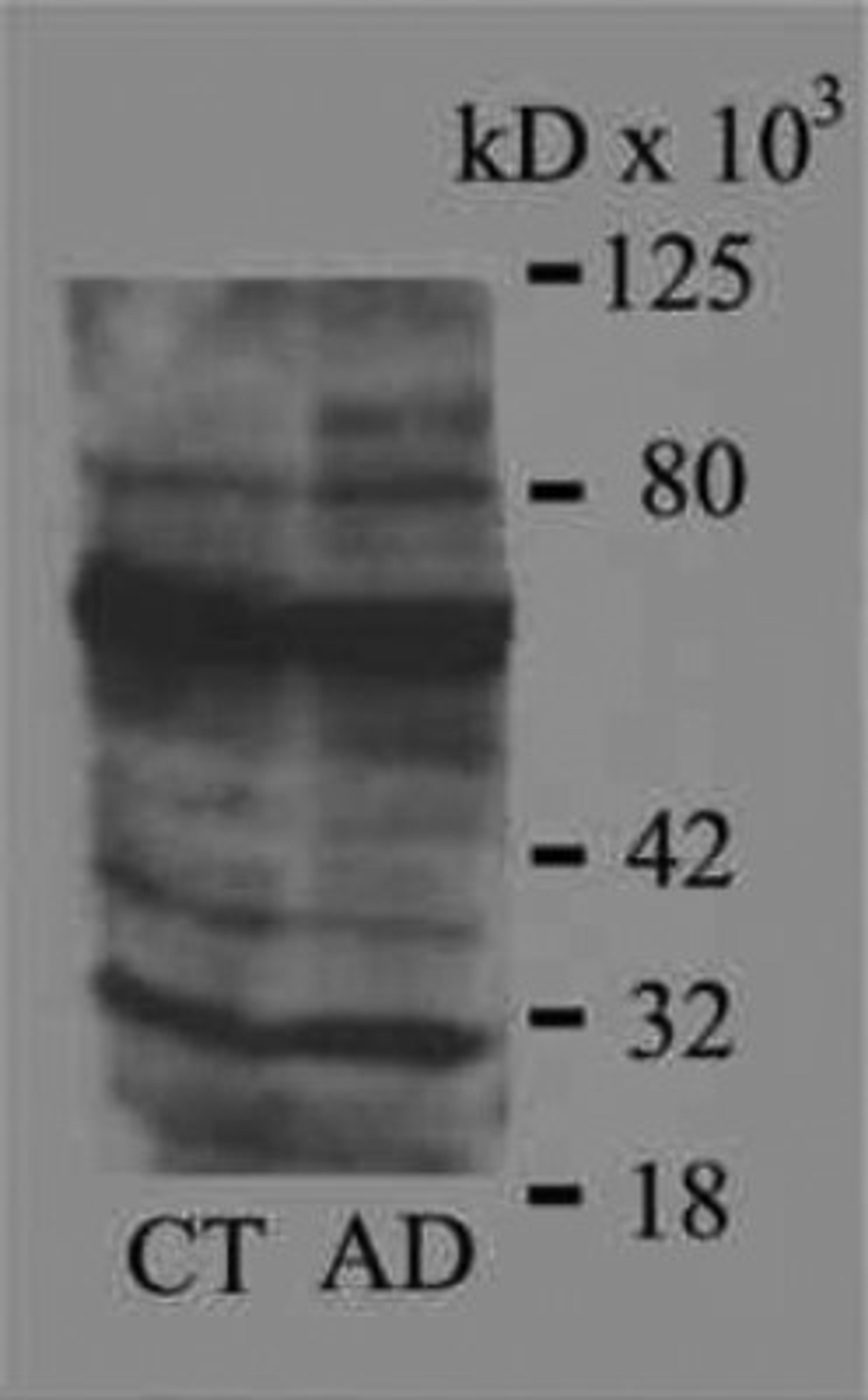 Western Blot: 4-Hydroxynonenal Antibody [NB100-63093] - Western blot of aged control and Alzheimer brain homogenates using 1:3,000 dilution of 4-HNE antiserum.