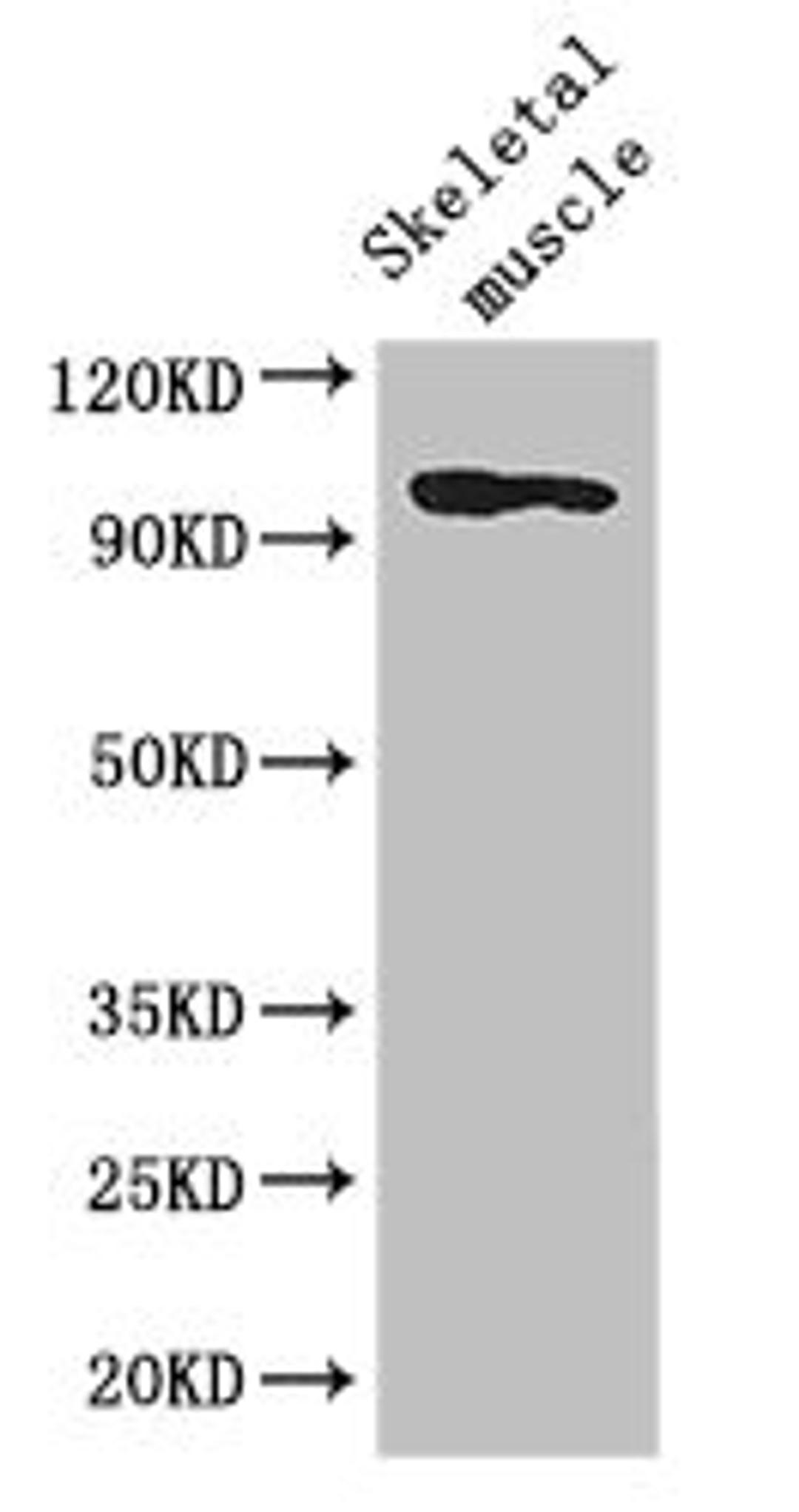 Western Blot. Positive WB detected in: Mouse skeletal muscle tissue. All lanes: SLFN11 antibody at 2.8ug/ml. Secondary. Goat polyclonal to rabbit IgG at 1/50000 dilution. Predicted band size: 103 kDa. Observed band size: 103 kDa.