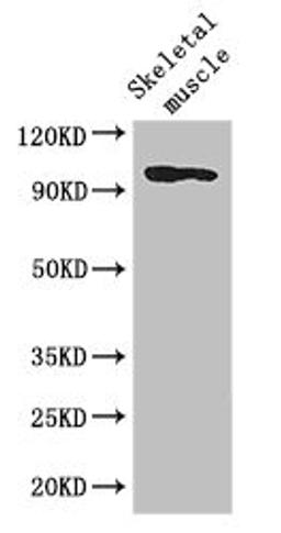 Western Blot. Positive WB detected in: Mouse skeletal muscle tissue. All lanes: SLFN11 antibody at 2.8ug/ml. Secondary. Goat polyclonal to rabbit IgG at 1/50000 dilution. Predicted band size: 103 kDa. Observed band size: 103 kDa.