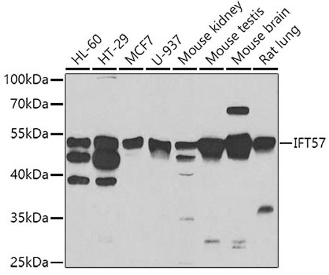 Western blot - IFT57 antibody (A7191)