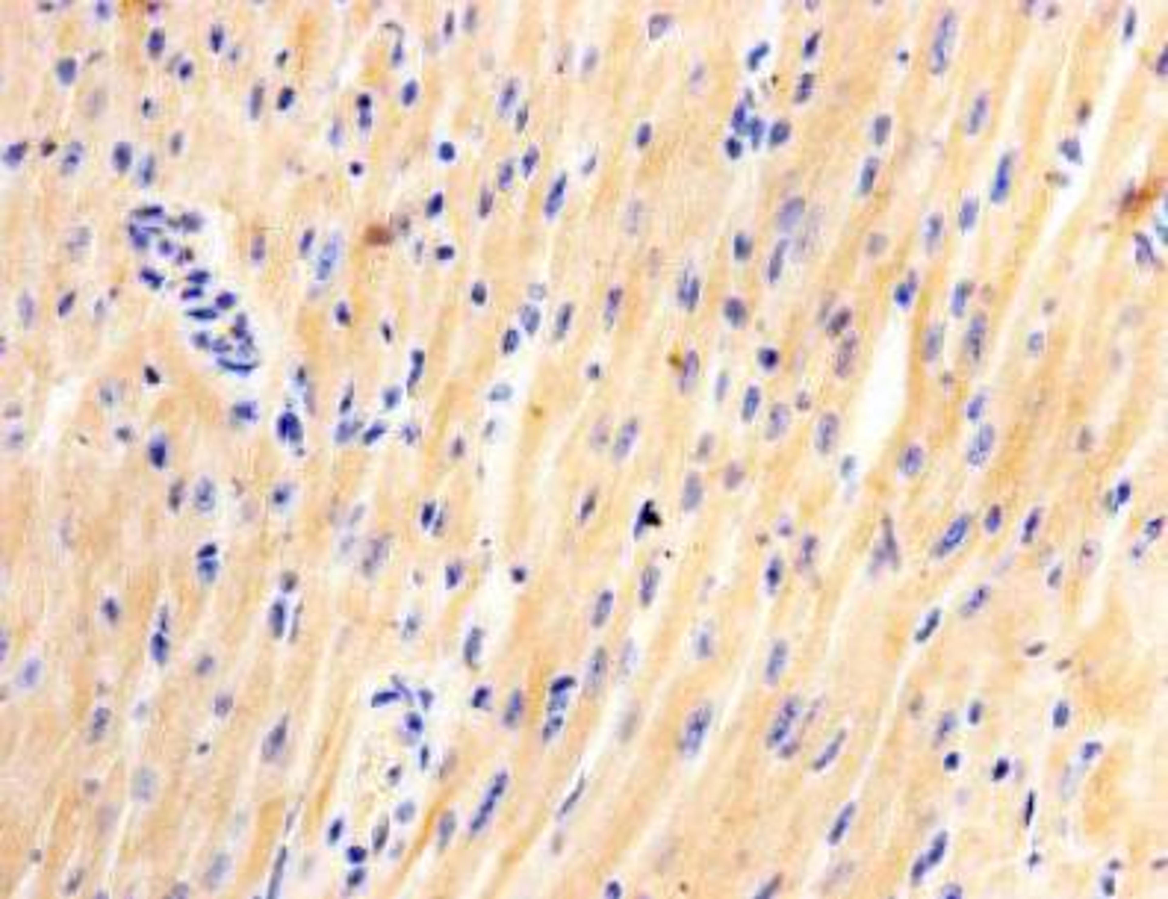 Immunoistochemical staining of mouse heart tissue using Junctophilin-2 antibody