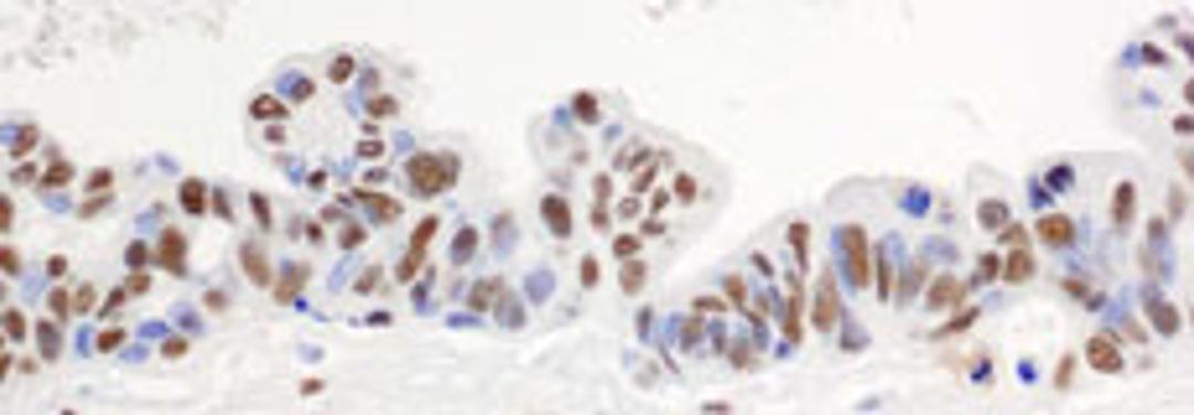 Detection of human hnRNP-H by immunohistochemistry.