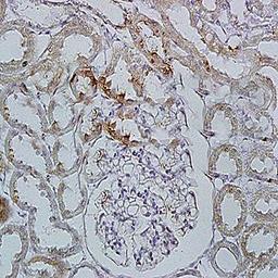 Immunohistochemical analysis of formalin-fixed and paraffin embedded rat kidney tissue (dilution at:1:200) using Integrin alpha E2 antibody