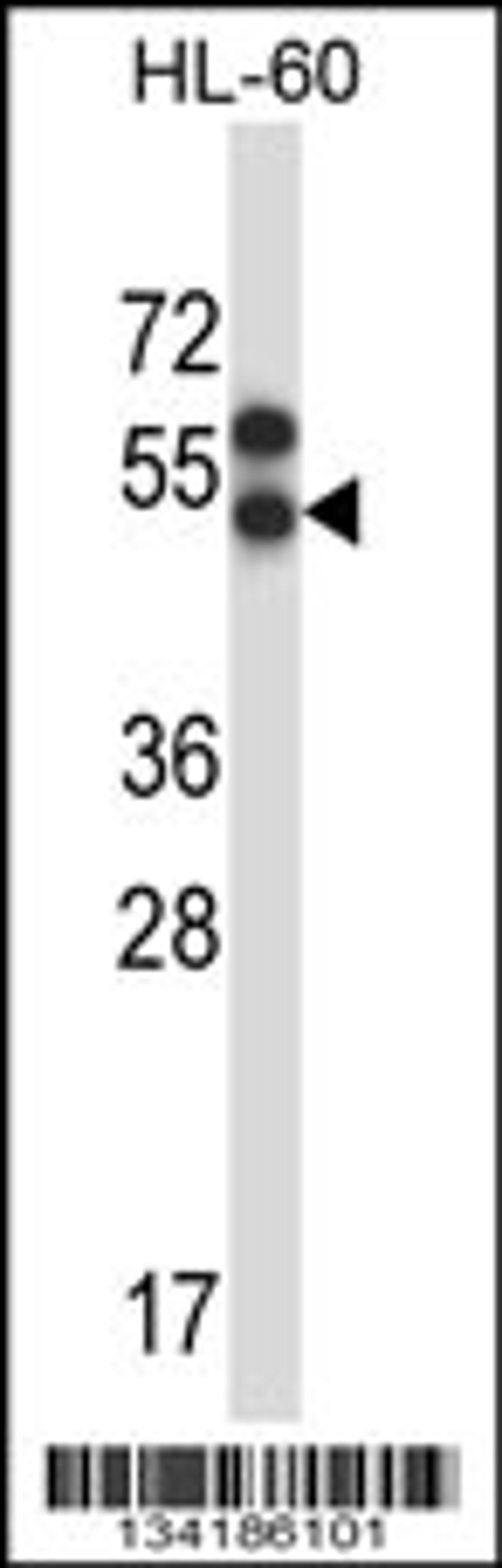 Western blot analysis in HL-60 cell line lysates (35ug/lane).