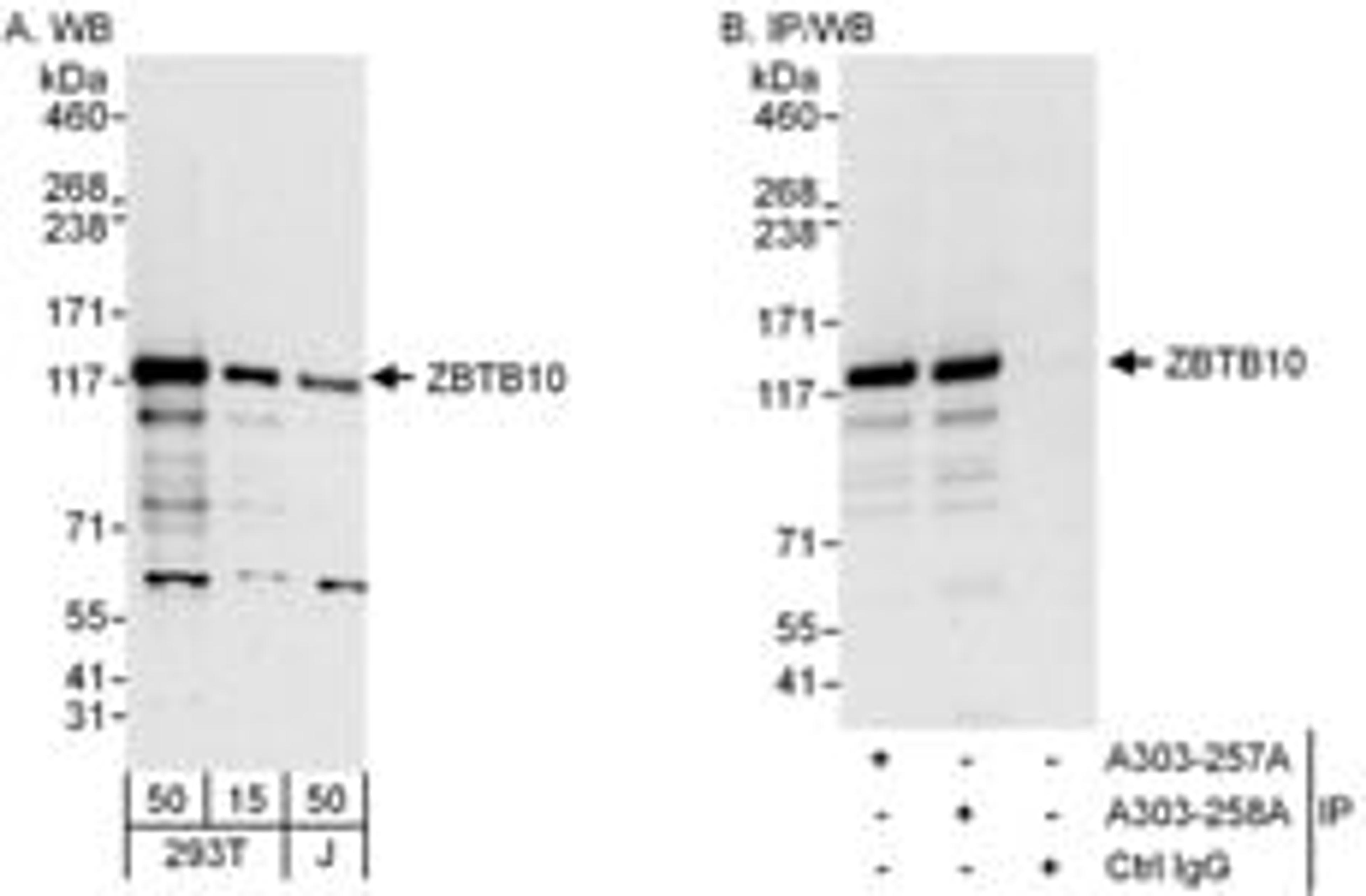 Detection of human ZBTB10 by western blot and immunoprecipitation.