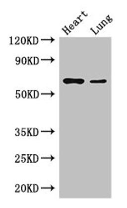 Western Blot. Positive WB detected in: Mouse heart tissue, Mouse lung tissue. All lanes: DCAF8 antibody at 3.5ug/ml. Secondary. Goat polyclonal to rabbit IgG at 1/50000 dilution. Predicted band size: 67, 31 kDa. Observed band size: 67 kDa. 