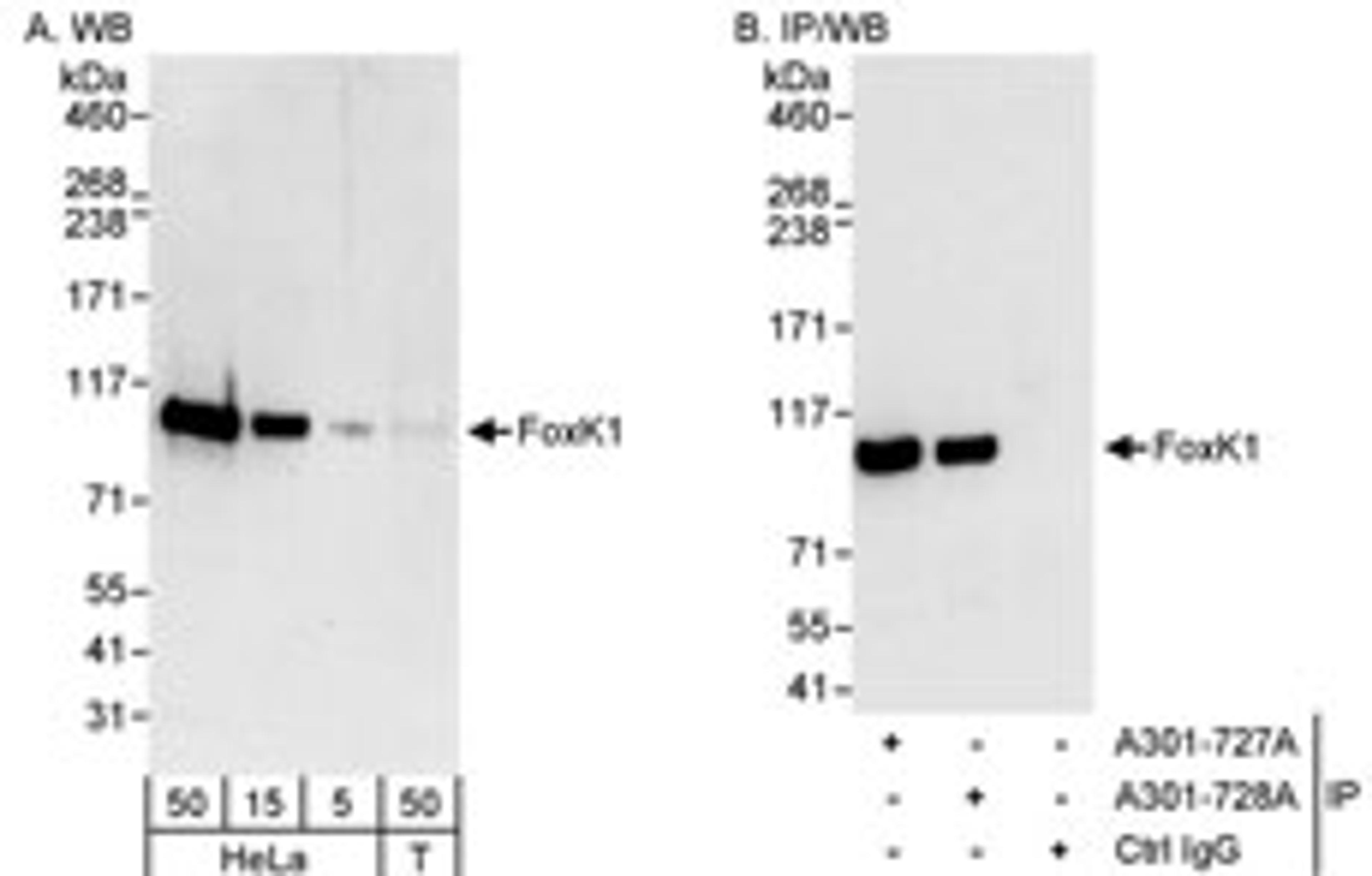 Detection of human FOXK1 by western blot and immunoprecipitation.