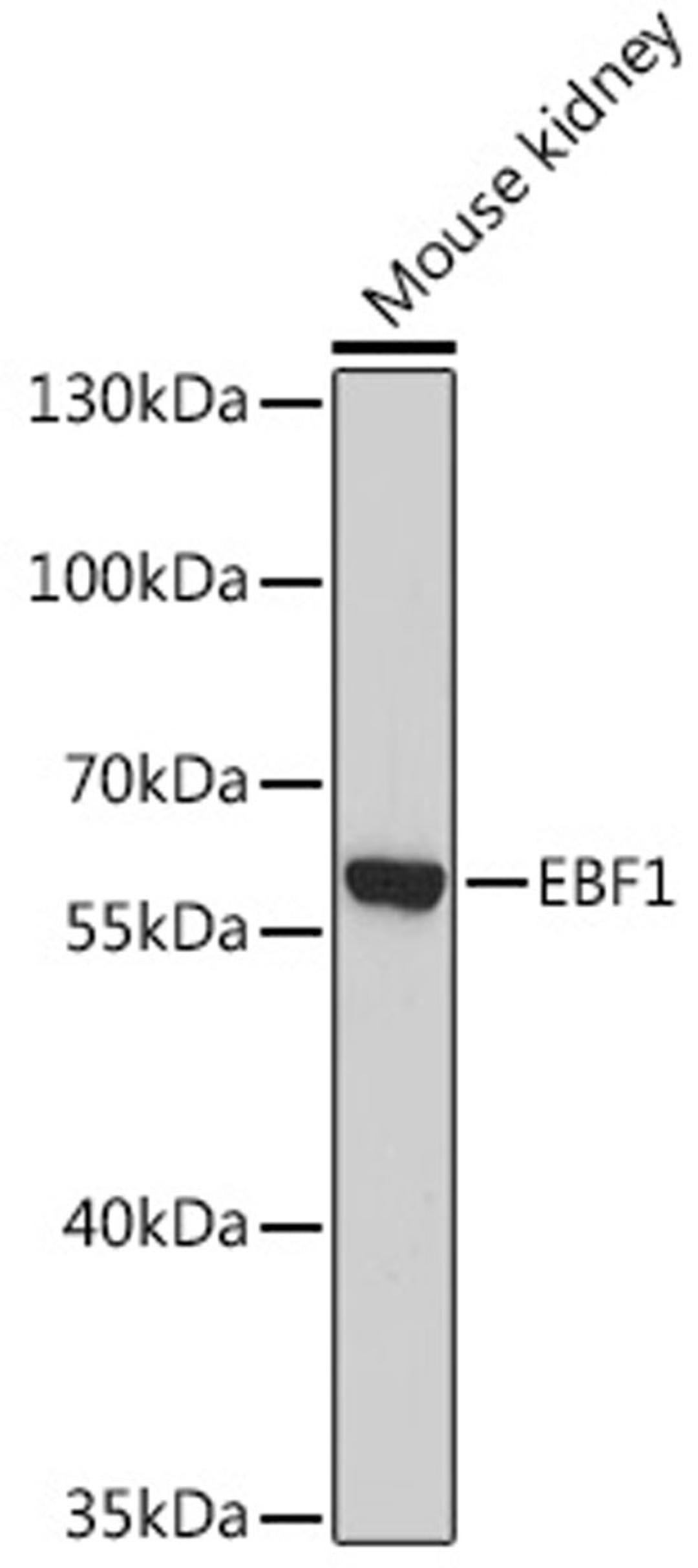 Western blot - EBF1 antibody (A13973)