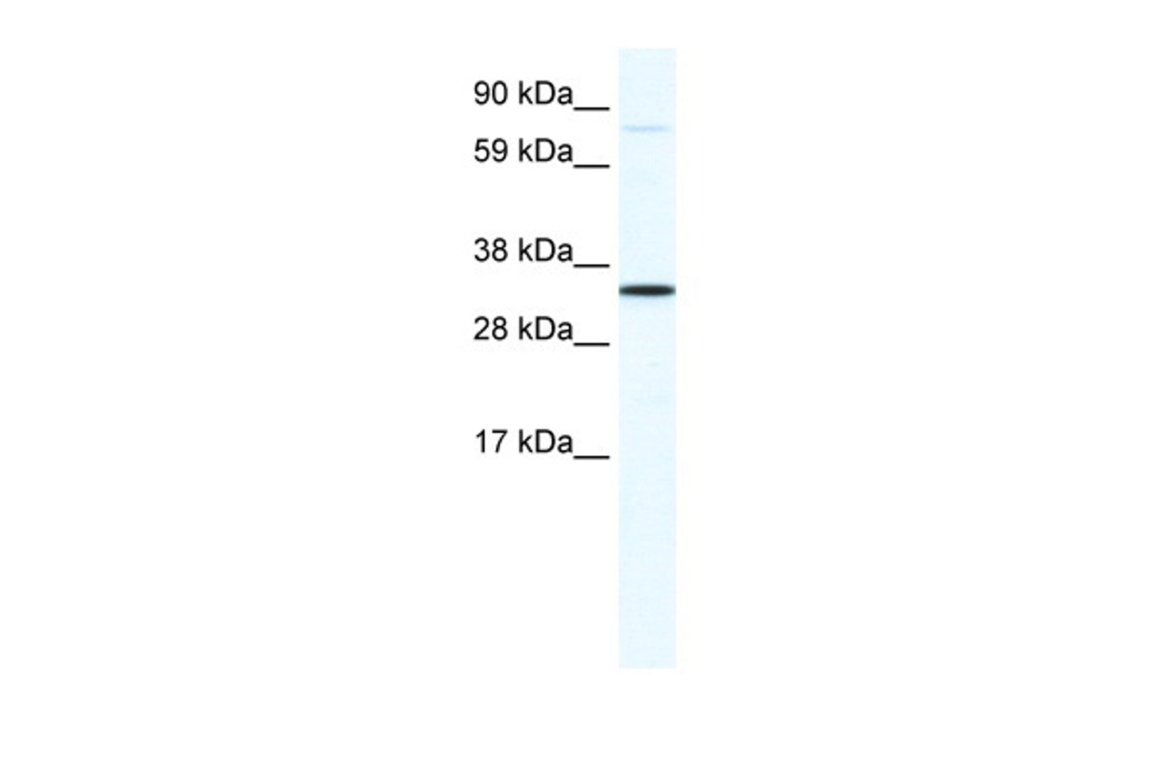 Antibody used in WB on Mouse SP2/0 at 1.25 ug/ml.