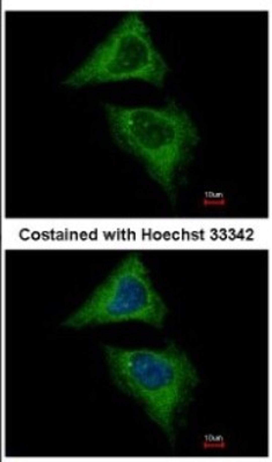 Immunocytochemistry/Immunofluorescence: Dynamin 2 Antibody [NBP2-16244] - Immunofluorescence analysis of methanol-fixed HeLa, using antibody at 1:500 dilution.