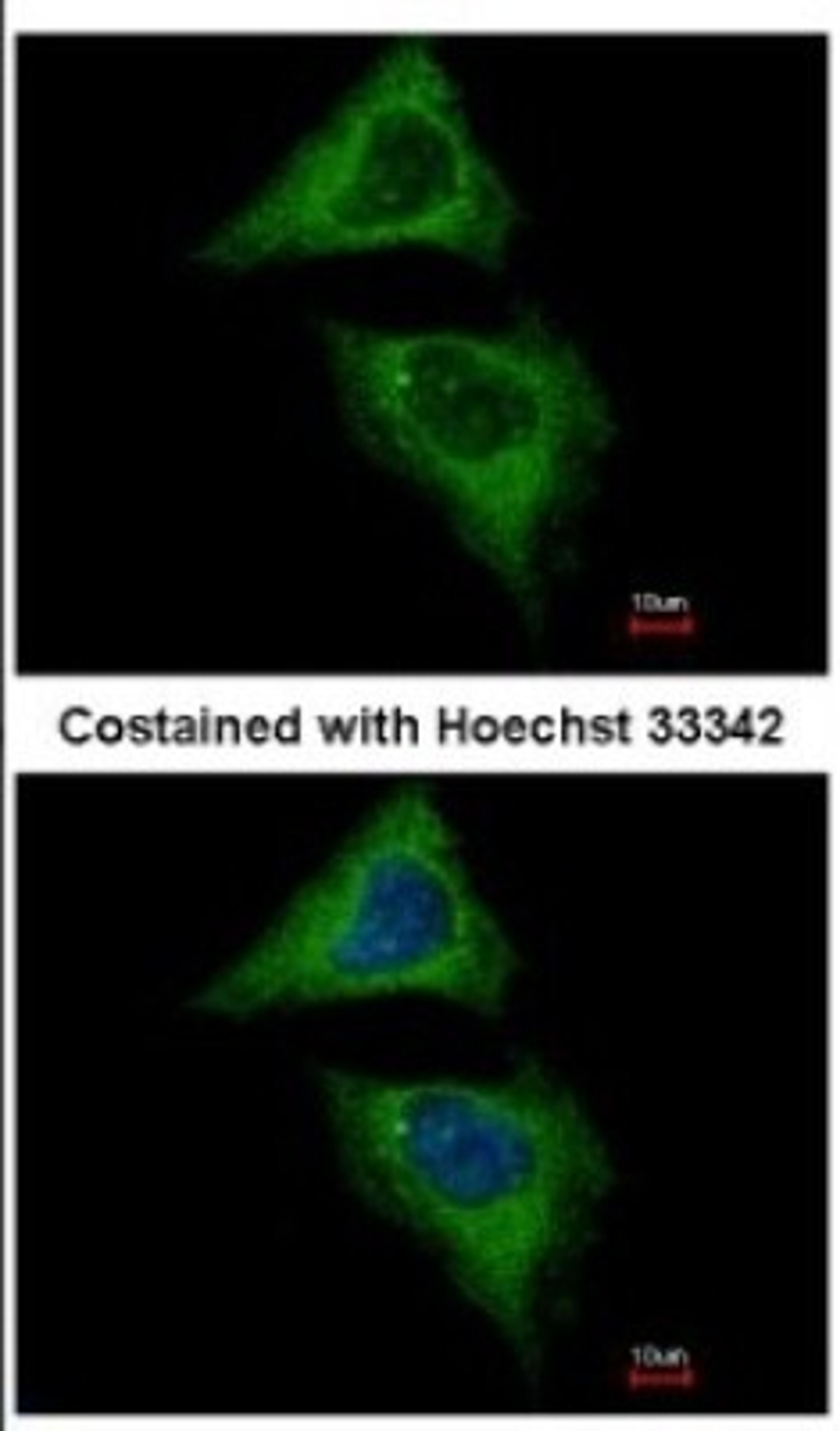 Immunocytochemistry/Immunofluorescence: Dynamin 2 Antibody [NBP2-16244] - Immunofluorescence analysis of methanol-fixed HeLa, using antibody at 1:500 dilution.