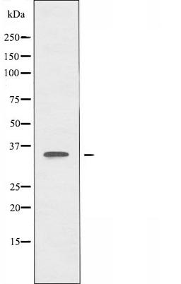 Western blot analysis of Jurkat cells, HepG2 cells and MCF-7 cells using OR51A4 antibody