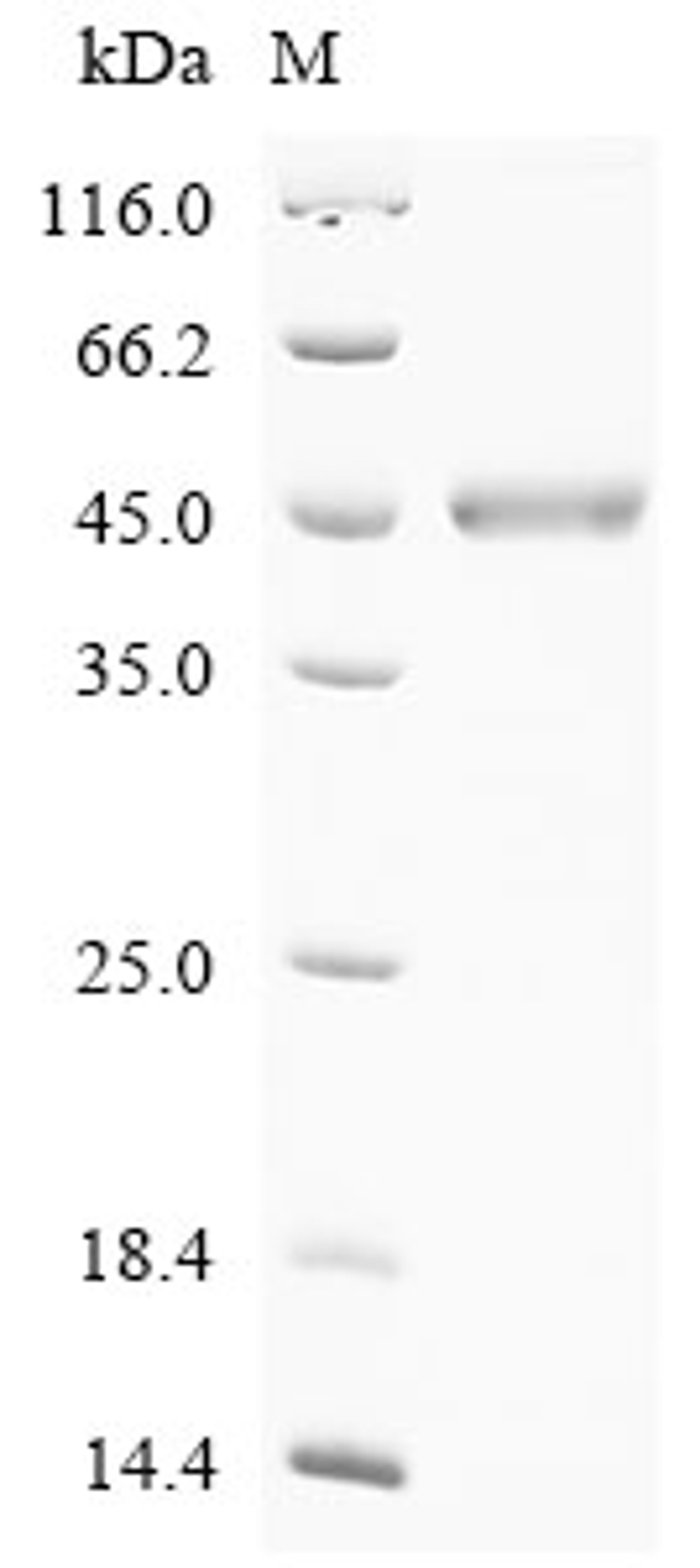 (Tris-Glycine gel) Discontinuous SDS-PAGE (reduced) with 5% enrichment gel and 15% separation gel.