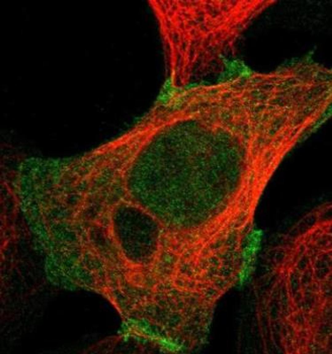 Immunocytochemistry/Immunofluorescence: Plakophilin 2 Antibody [NBP1-86078] - Staining of human cell line A-431 shows positivity in cell junctions & nucleus but excluded from the nucleoli. Antibody staining is shown in green.